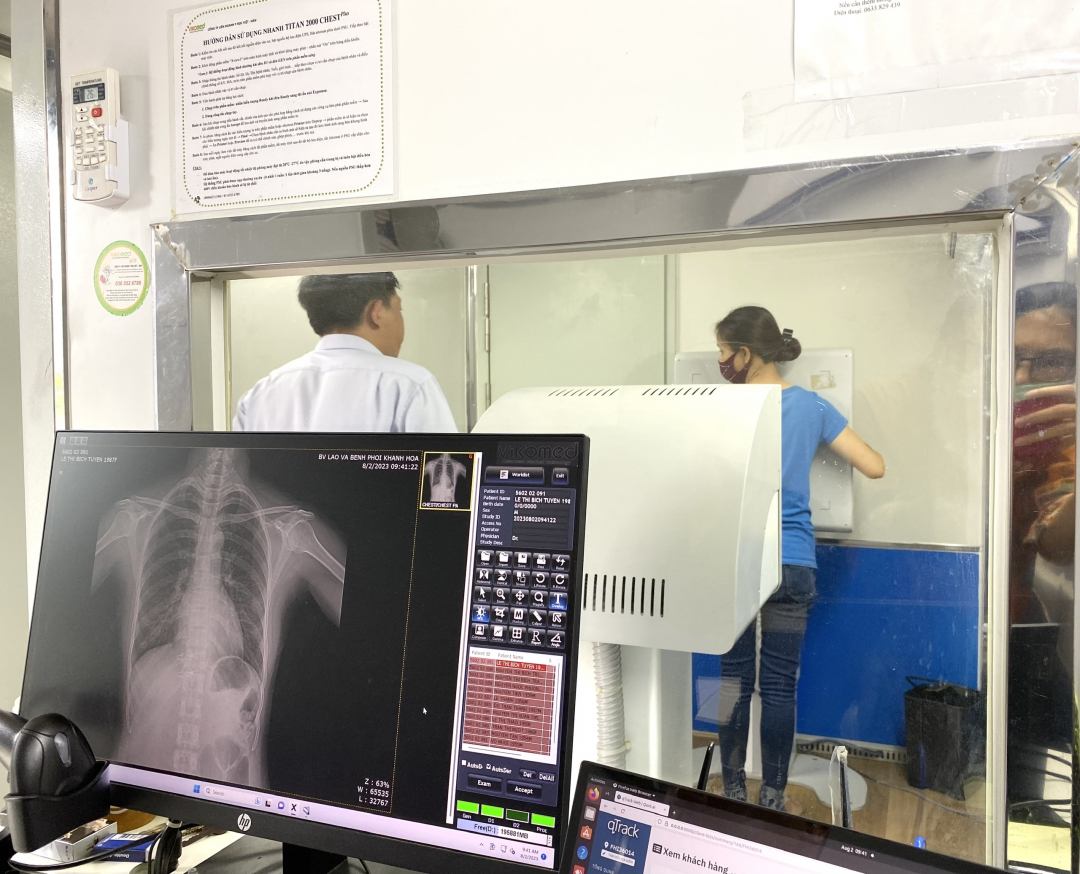 Community-based tuberculosis screening towards ending tuberculosis by 2030