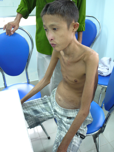 Wounded soldier’s family needs help