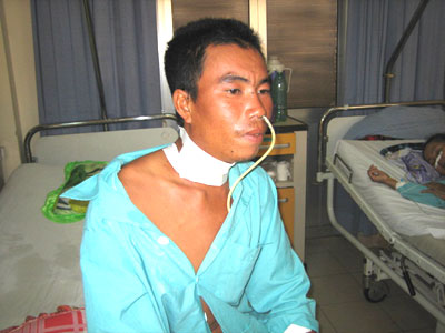 Patient attacked by needlefish saved