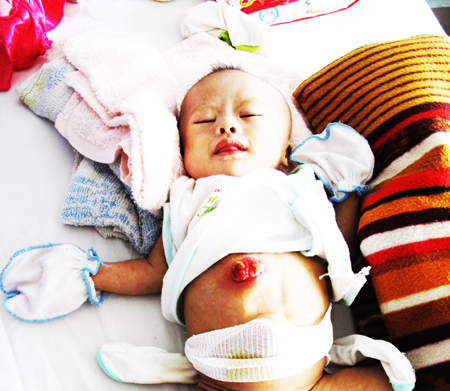 An infant suffering many diseases needs help