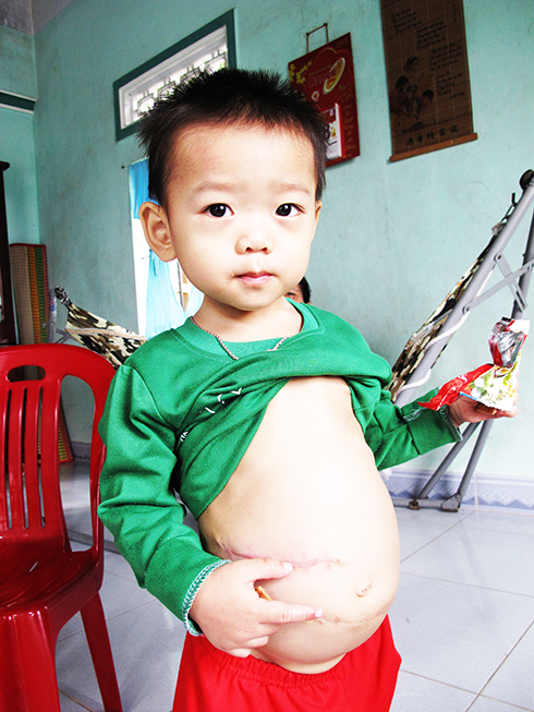 Two children suffering from many serious birth defects need help